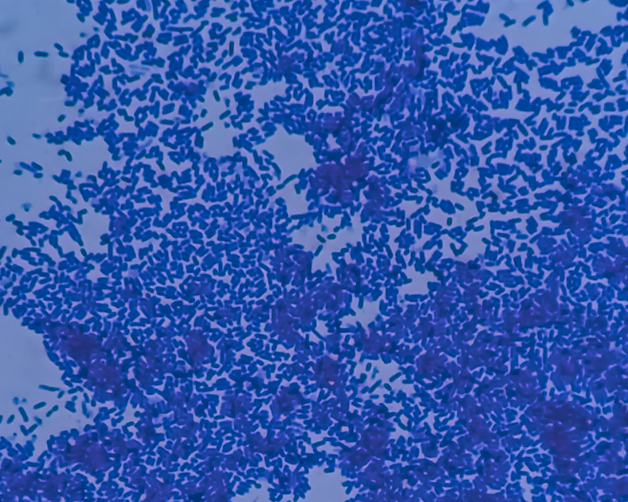 Blue monochrome image of bacteria under a microscope.